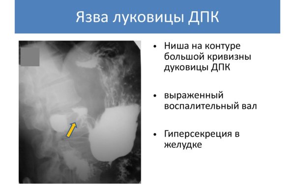 Как зарегаться на кракене